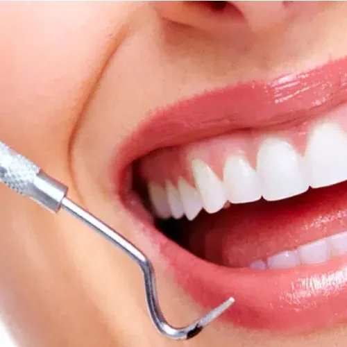 Cosmetic Dentistry