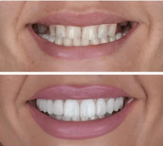 Cosmetic Dentistry